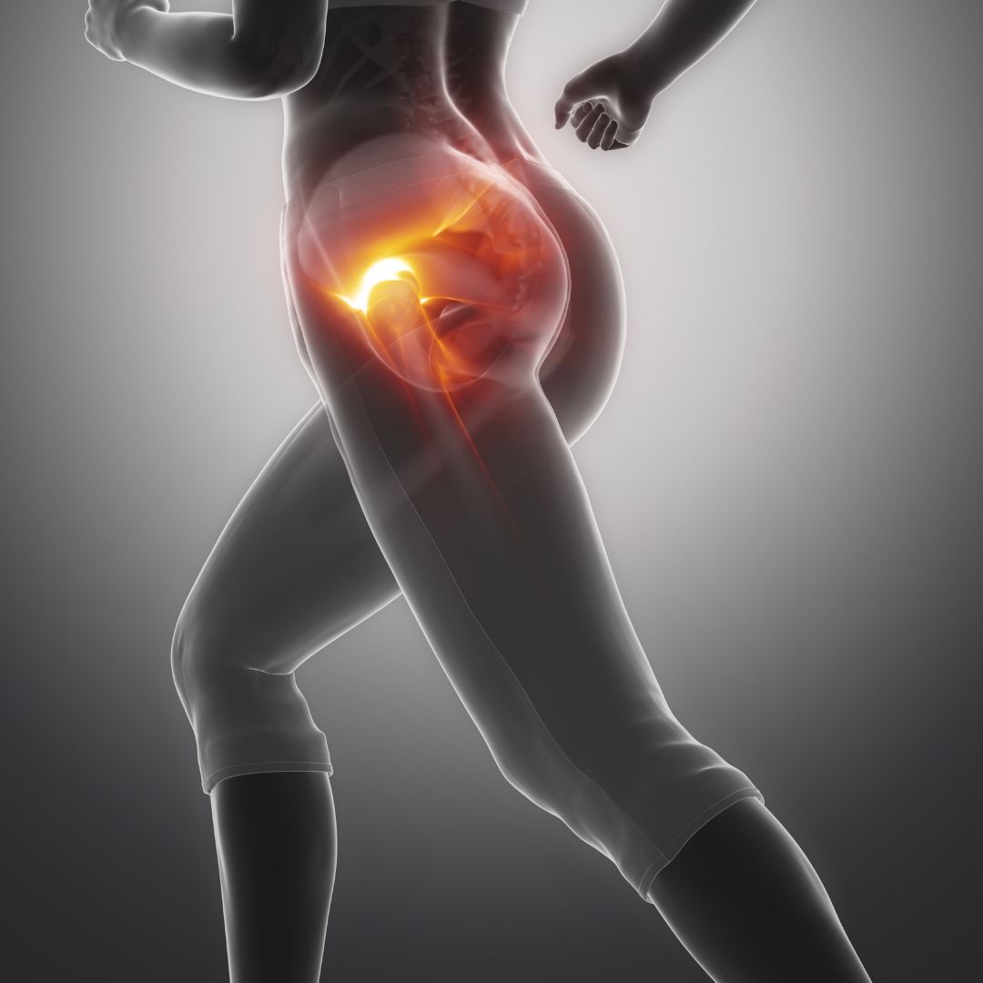 Anatomical illustration of a running figure with the front of the hip highlighted, showing where hip flexor strain pain is felt