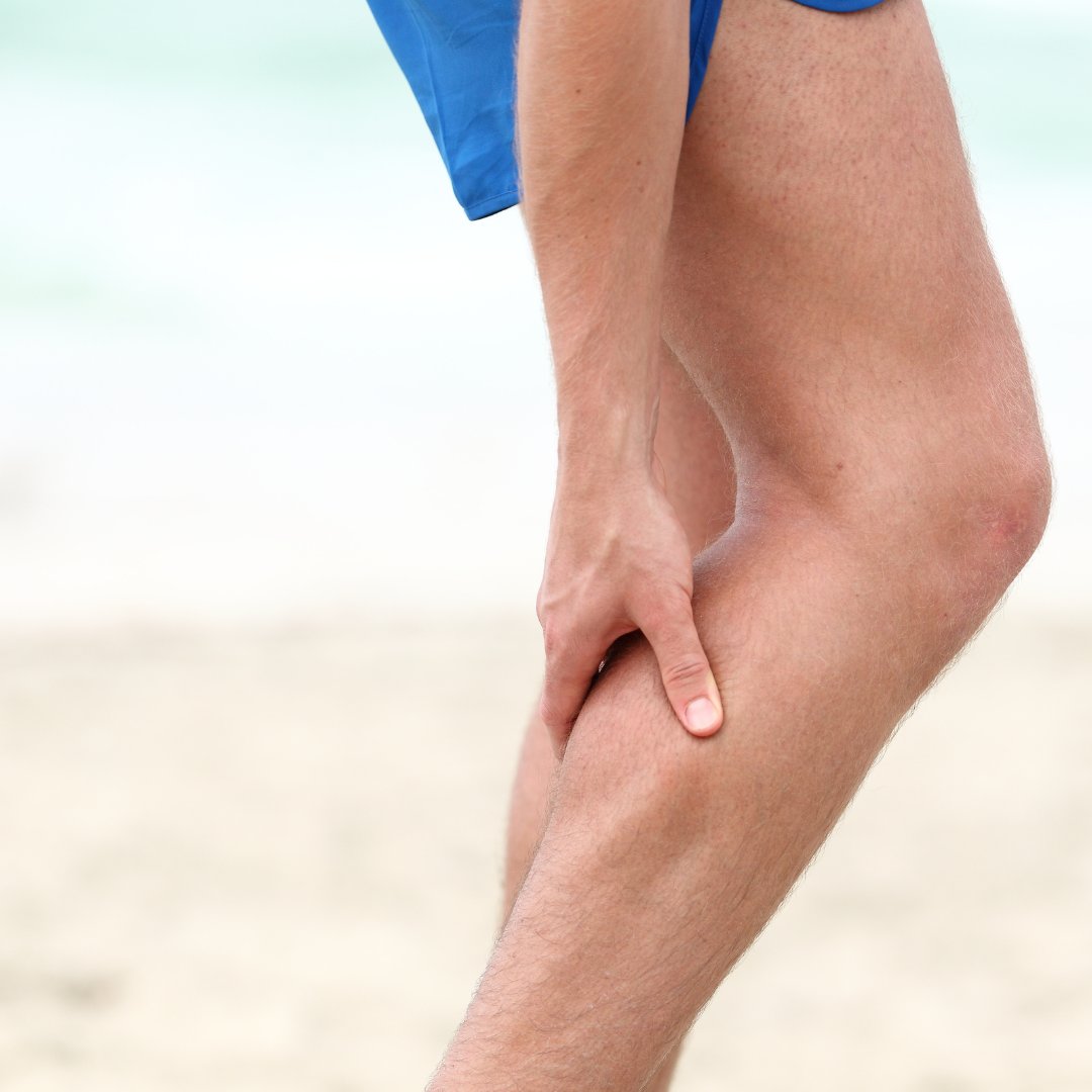 Man on a beach holding the back of his lower leg with calf pain, a typical calf strain presentation